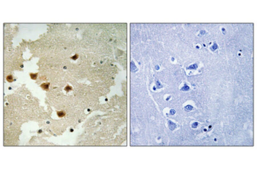 Immunohistochemistry - Anti-Huntingtin (phospho Ser421) Antibody (A1050) - Antibodies.com