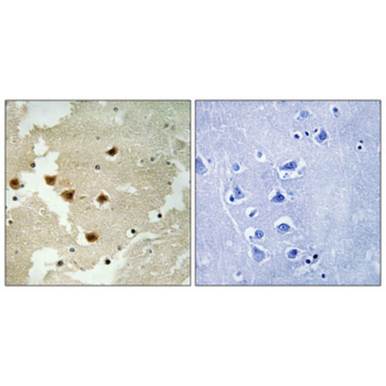 Immunohistochemistry - Anti-Huntingtin (phospho Ser421) Antibody (A1050) - Antibodies.com