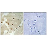 Immunohistochemistry - Anti-Huntingtin (phospho Ser421) Antibody (A1050) - Antibodies.com