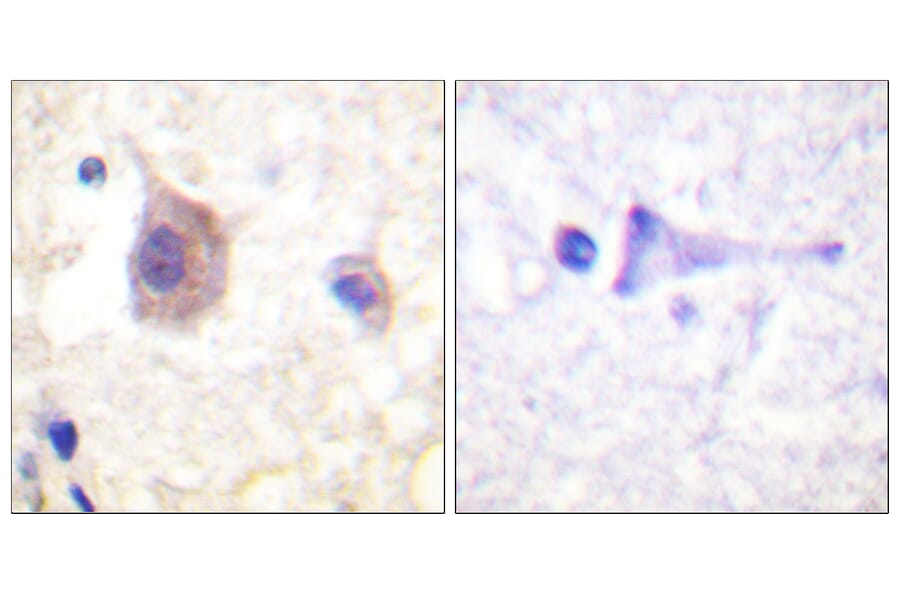 Immunohistochemistry - Anti-PKC mu (phospho Tyr463) Antibody (A0807) - Antibodies.com