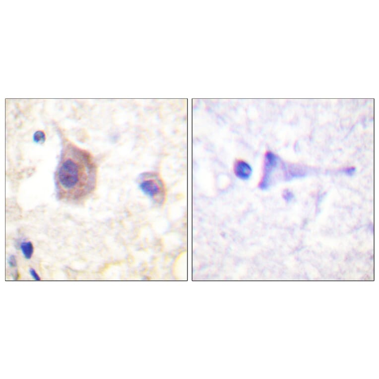 Immunohistochemistry - Anti-PKC mu (phospho Tyr463) Antibody (A0807) - Antibodies.com