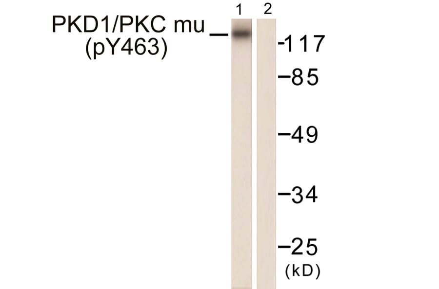 Western Blot - Anti-PKC mu (phospho Tyr463) Antibody (A0807) - Antibodies.com