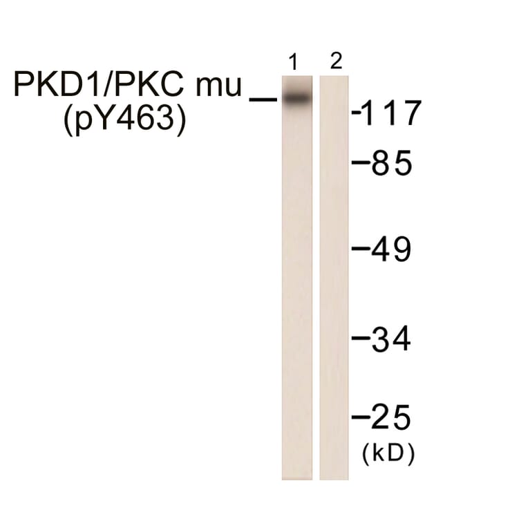 Western Blot - Anti-PKC mu (phospho Tyr463) Antibody (A0807) - Antibodies.com
