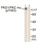 Western Blot - Anti-PKC mu (phospho Tyr463) Antibody (A0807) - Antibodies.com