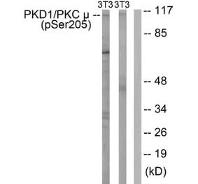 Western Blot - Anti-PKC mu (phospho Ser205) Antibody (A0806) - Antibodies.com