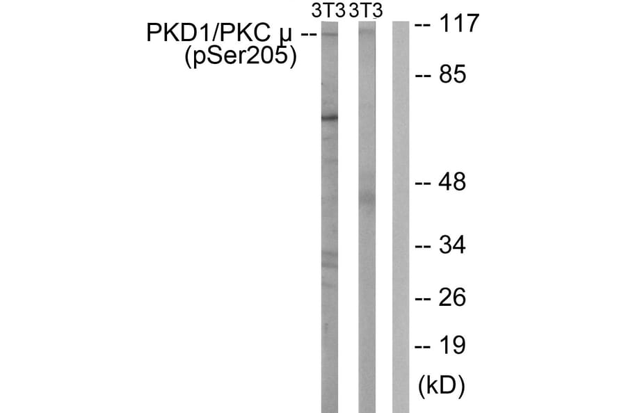 Western Blot - Anti-PKC mu (phospho Ser205) Antibody (A0806) - Antibodies.com