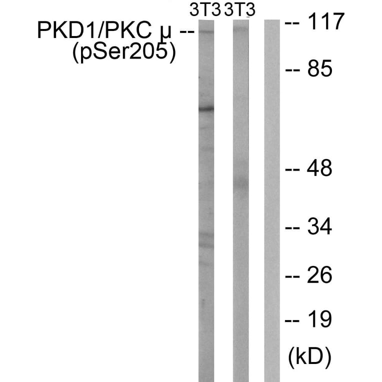 Western Blot - Anti-PKC mu (phospho Ser205) Antibody (A0806) - Antibodies.com