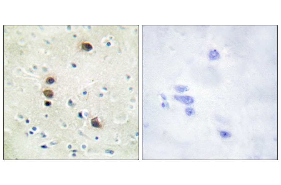 Immunohistochemistry - Anti-PKC mu (phospho Ser205) Antibody (A0806) - Antibodies.com