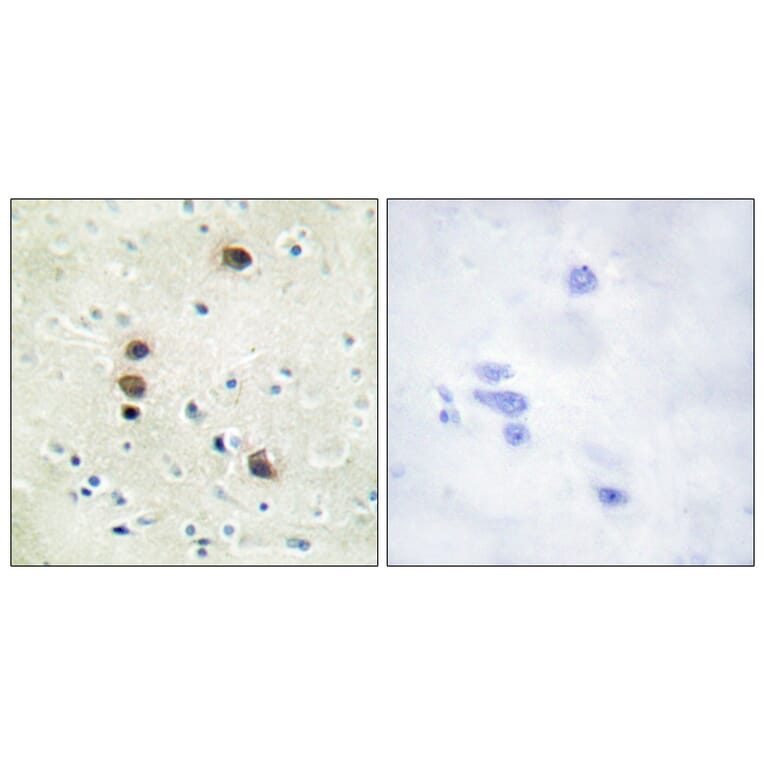 Immunohistochemistry - Anti-PKC mu (phospho Ser205) Antibody (A0806) - Antibodies.com
