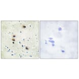Immunohistochemistry - Anti-PKC mu (phospho Ser205) Antibody (A0806) - Antibodies.com