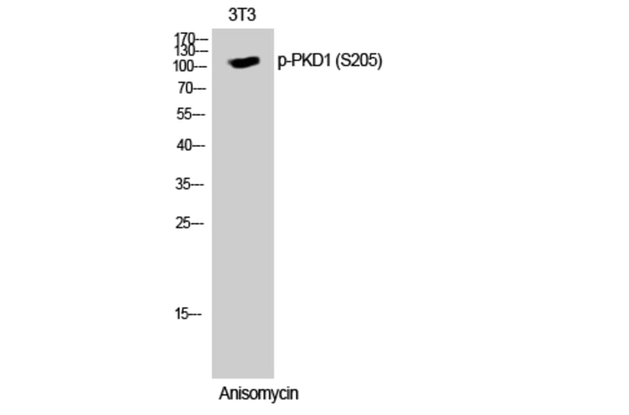 Western Blot - Anti-PKC mu (phospho Ser205) Antibody (A0806) - Antibodies.com