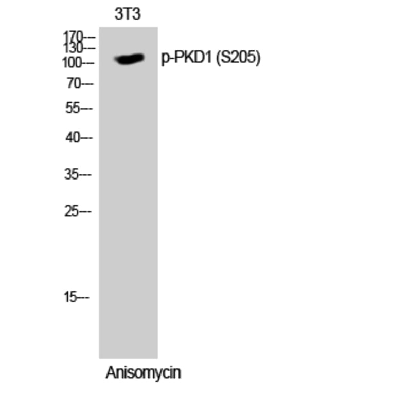 Western Blot - Anti-PKC mu (phospho Ser205) Antibody (A0806) - Antibodies.com