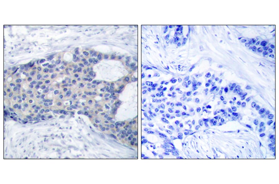 Immunohistochemistry - Anti-ZAP-70 (phospho Tyr493) Antibody (A7256) - Antibodies.com