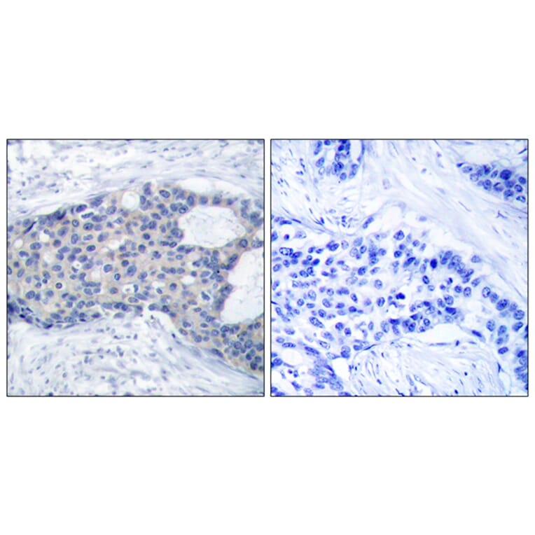 Immunohistochemistry - Anti-ZAP-70 (phospho Tyr493) Antibody (A7256) - Antibodies.com