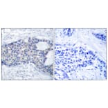 Immunohistochemistry - Anti-ZAP-70 (phospho Tyr493) Antibody (A7256) - Antibodies.com