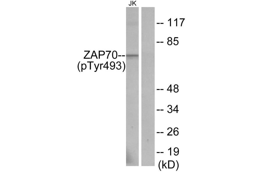 Western Blot - Anti-ZAP-70 (phospho Tyr493) Antibody (A7256) - Antibodies.com