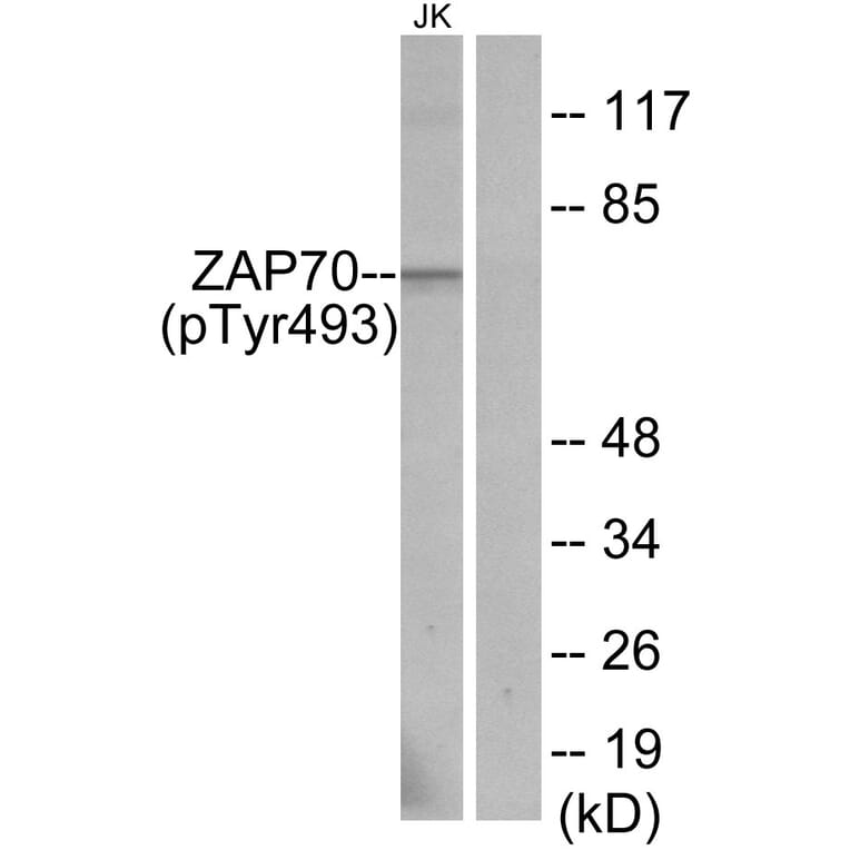 Western Blot - Anti-ZAP-70 (phospho Tyr493) Antibody (A7256) - Antibodies.com