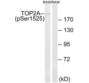 Western Blot - Anti-TOP2A (phospho Ser1525) Antibody (A8439) - Antibodies.com