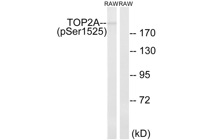Western Blot - Anti-TOP2A (phospho Ser1525) Antibody (A8439) - Antibodies.com