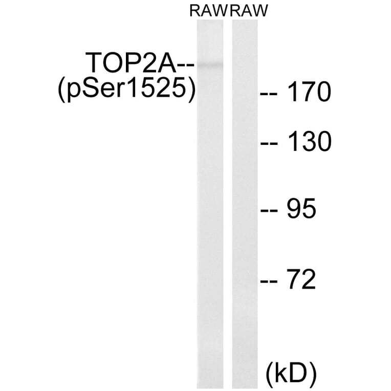 Western Blot - Anti-TOP2A (phospho Ser1525) Antibody (A8439) - Antibodies.com