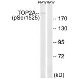 Western Blot - Anti-TOP2A (phospho Ser1525) Antibody (A8439) - Antibodies.com