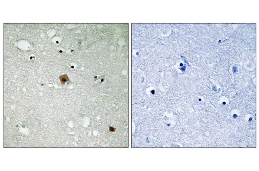 Immunohistochemistry - Anti-TOP2A (phospho Ser1525) Antibody (A8439) - Antibodies.com