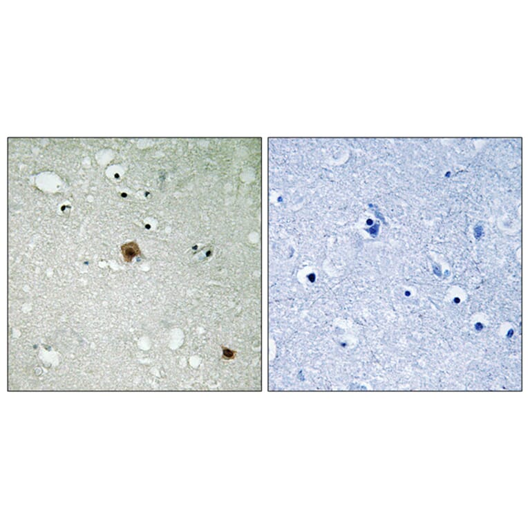 Immunohistochemistry - Anti-TOP2A (phospho Ser1525) Antibody (A8439) - Antibodies.com