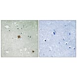 Immunohistochemistry - Anti-TOP2A (phospho Ser1525) Antibody (A8439) - Antibodies.com