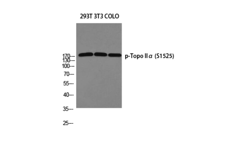 Western Blot - Anti-TOP2A (phospho Ser1525) Antibody (A8439) - Antibodies.com