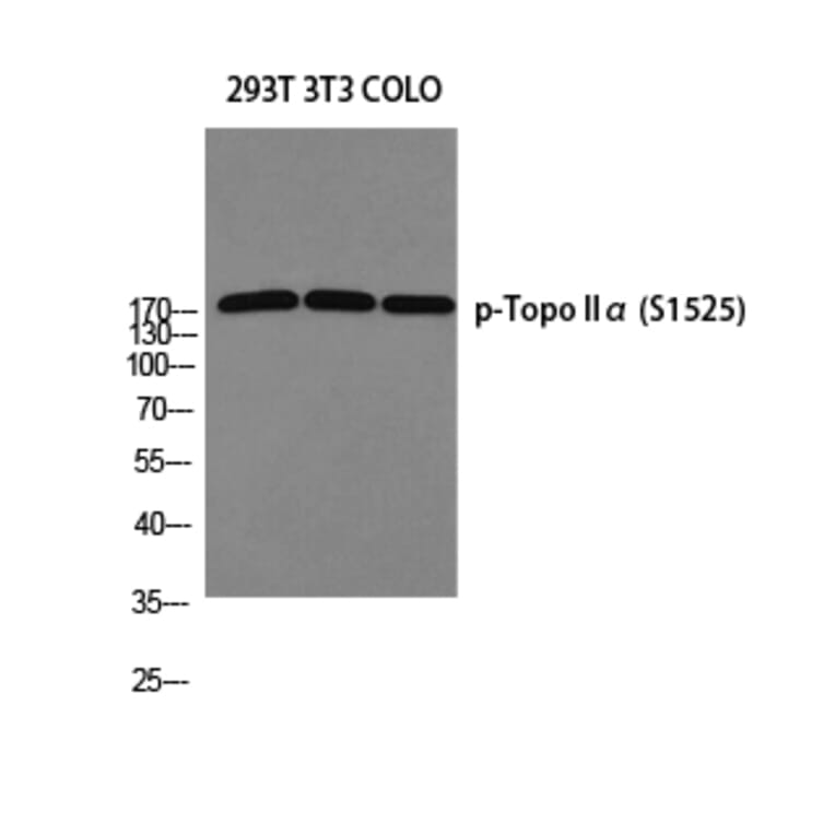 Western Blot - Anti-TOP2A (phospho Ser1525) Antibody (A8439) - Antibodies.com