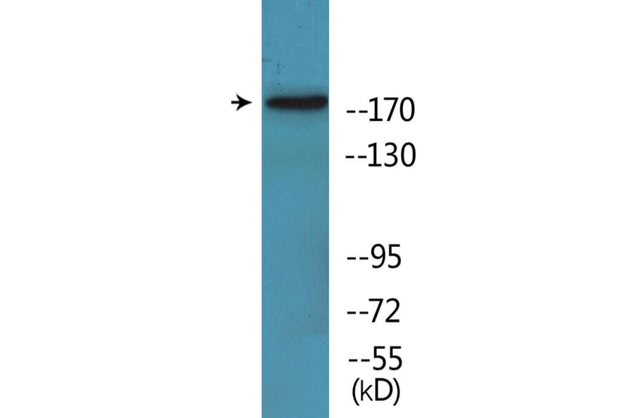 Western Blot - Anti-TOP2A (phospho Ser1525) Antibody (P12-1191) - Antibodies.com