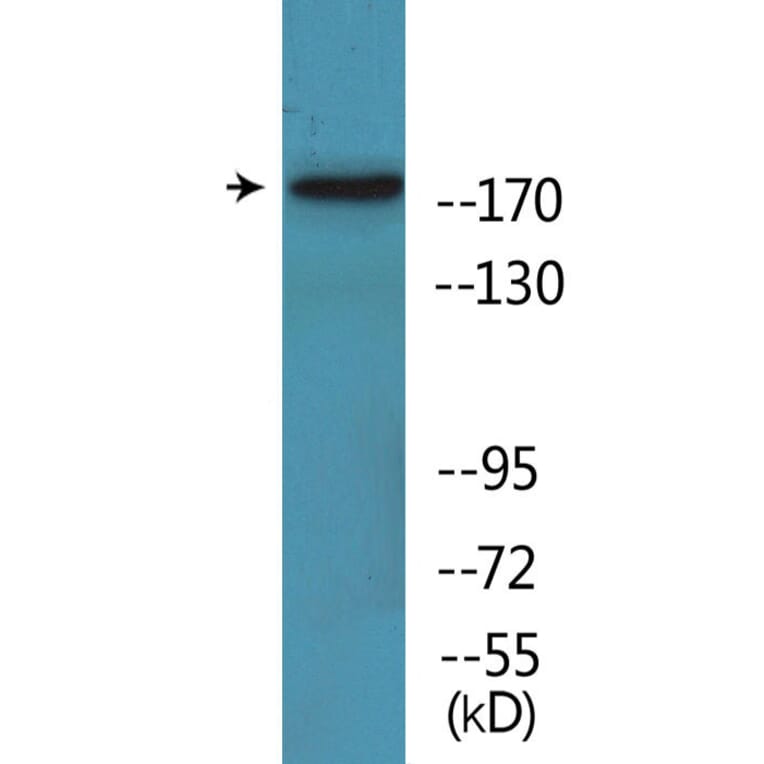Western Blot - Anti-TOP2A (phospho Ser1525) Antibody (P12-1191) - Antibodies.com