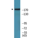 Western Blot - Anti-TOP2A (phospho Ser1525) Antibody (P12-1191) - Antibodies.com