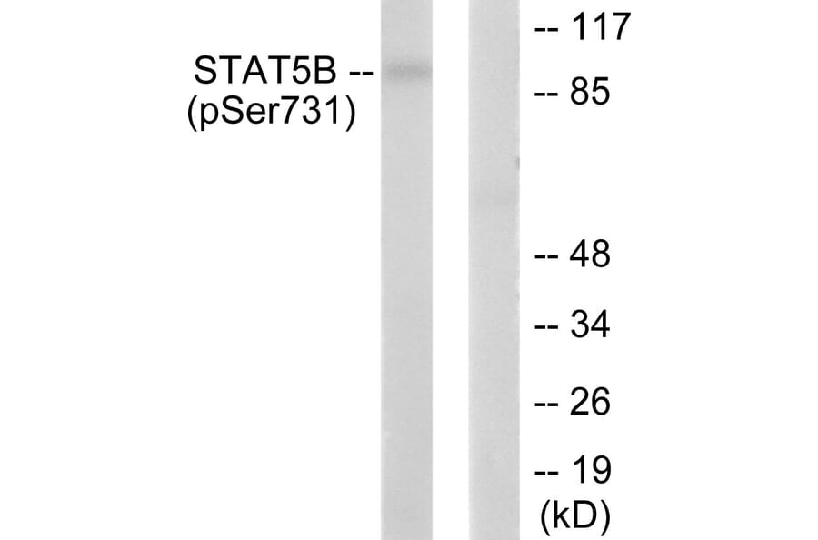 Western Blot - Anti-STAT5B (phospho Ser731) Antibody (A0090) - Antibodies.com