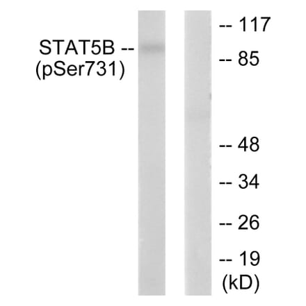 Western Blot - Anti-STAT5B (phospho Ser731) Antibody (A0090) - Antibodies.com