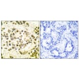 Immunohistochemistry - Anti-STAT5B (phospho Ser731) Antibody (A0090) - Antibodies.com