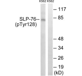 Western Blot - Anti-SLP-76 (phospho Tyr128) Antibody (A8209) - Antibodies.com