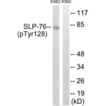 Western Blot - Anti-SLP-76 (phospho Tyr128) Antibody (A8209) - Antibodies.com