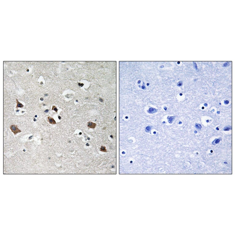 Immunohistochemistry - Anti-SLP-76 (phospho Tyr128) Antibody (A8209) - Antibodies.com