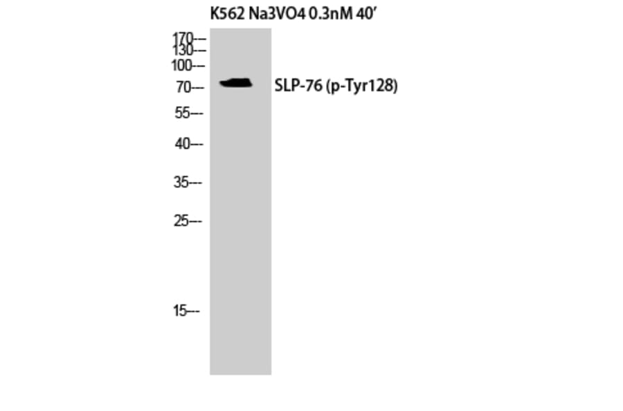 Western Blot - Anti-SLP-76 (phospho Tyr128) Antibody (A8209) - Antibodies.com