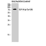 Western Blot - Anti-SLP-76 (phospho Tyr128) Antibody (A8209) - Antibodies.com