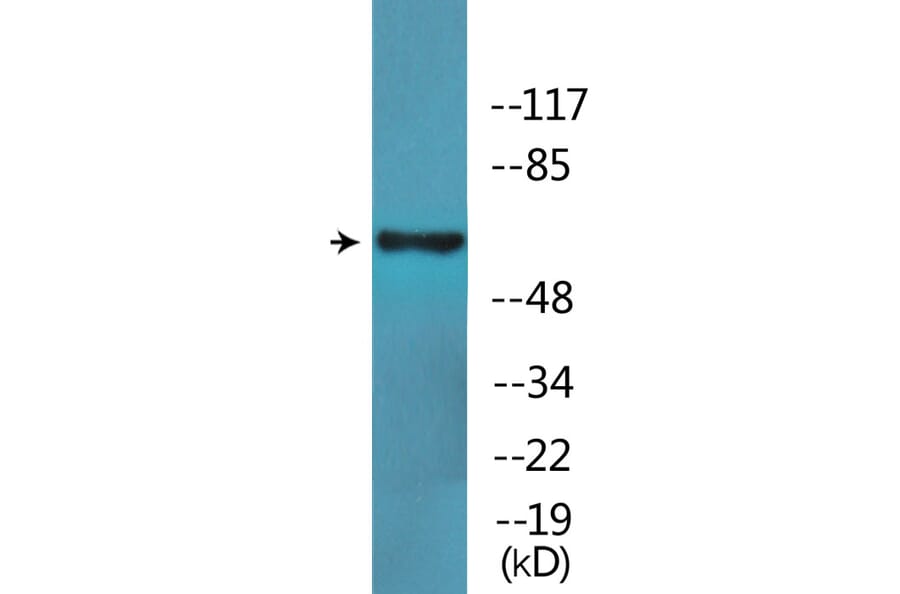 Western Blot - Anti-SLP-76 (phospho Tyr128) Antibody (P12-1177) - Antibodies.com