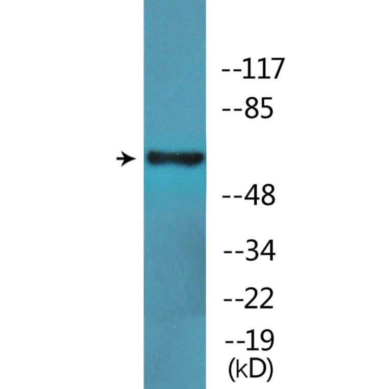 Western Blot - Anti-SLP-76 (phospho Tyr128) Antibody (P12-1177) - Antibodies.com