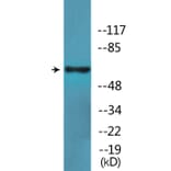 Western Blot - Anti-SLP-76 (phospho Tyr128) Antibody (P12-1177) - Antibodies.com