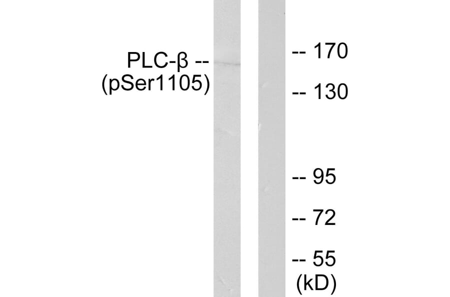 Western Blot - Anti-PLCB3 (phospho Ser1105) Antibody (A0078) - Antibodies.com