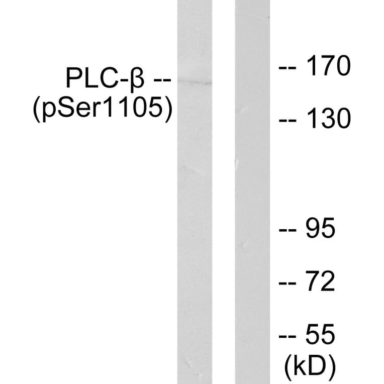 Western Blot - Anti-PLCB3 (phospho Ser1105) Antibody (A0078) - Antibodies.com