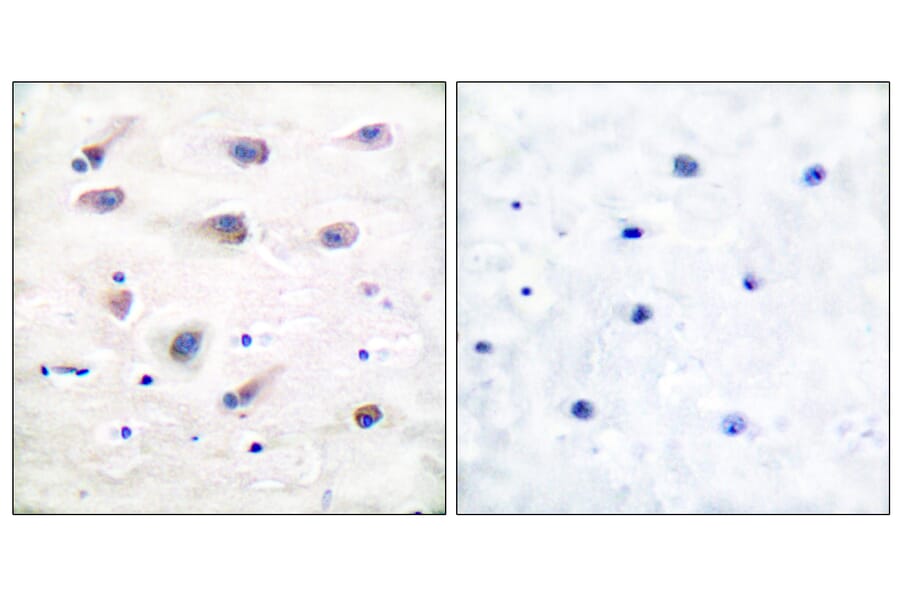 Immunohistochemistry - Anti-PLCB3 (phospho Ser1105) Antibody (A0078) - Antibodies.com