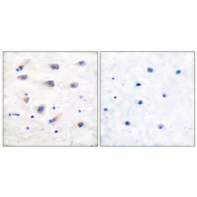 Immunohistochemistry - Anti-PLCB3 (phospho Ser1105) Antibody (A0078) - Antibodies.com