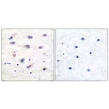 Immunohistochemistry - Anti-PLCB3 (phospho Ser1105) Antibody (A0078) - Antibodies.com