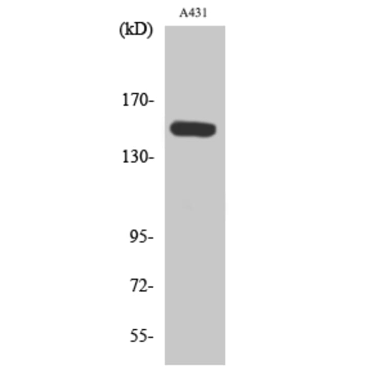 Western Blot - Anti-PLCB3 (phospho Ser1105) Antibody (A0078) - Antibodies.com